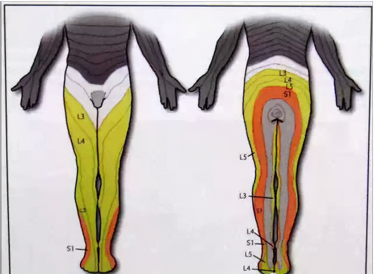 腰椎间盘突出严重程度划分标准,老人腰椎间盘突出压迫神经腿疼