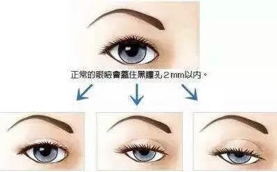 辛芷蕾嘴唇外翻面相,辛芷蕾面相分析婚姻