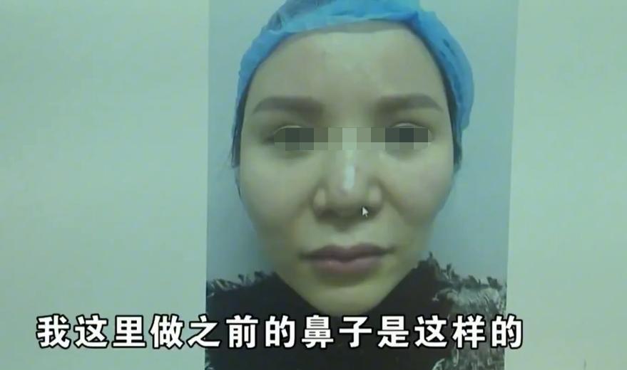 一弯腰就流鼻血？女子吃辣椒打喷嚏爆出“硬物”：我整个人都吓傻了