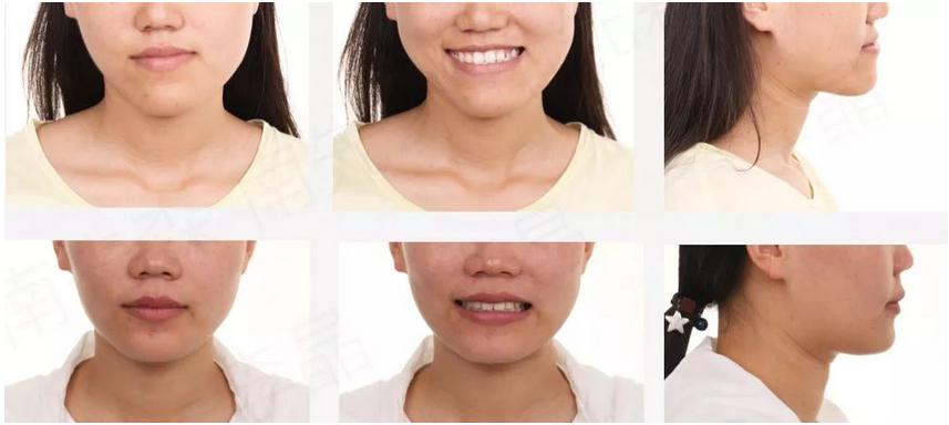 苹果肌下垂法令纹重用什么精华,vol.5