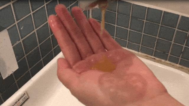 控油好不伤头皮的好洗发水,为什么有的洗发水用了头皮特别多