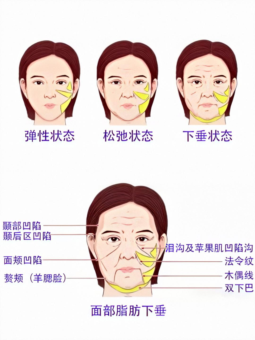不做拉皮怎么能把脸上皱纹解决了,28岁脸皮松弛皱纹多怎么办