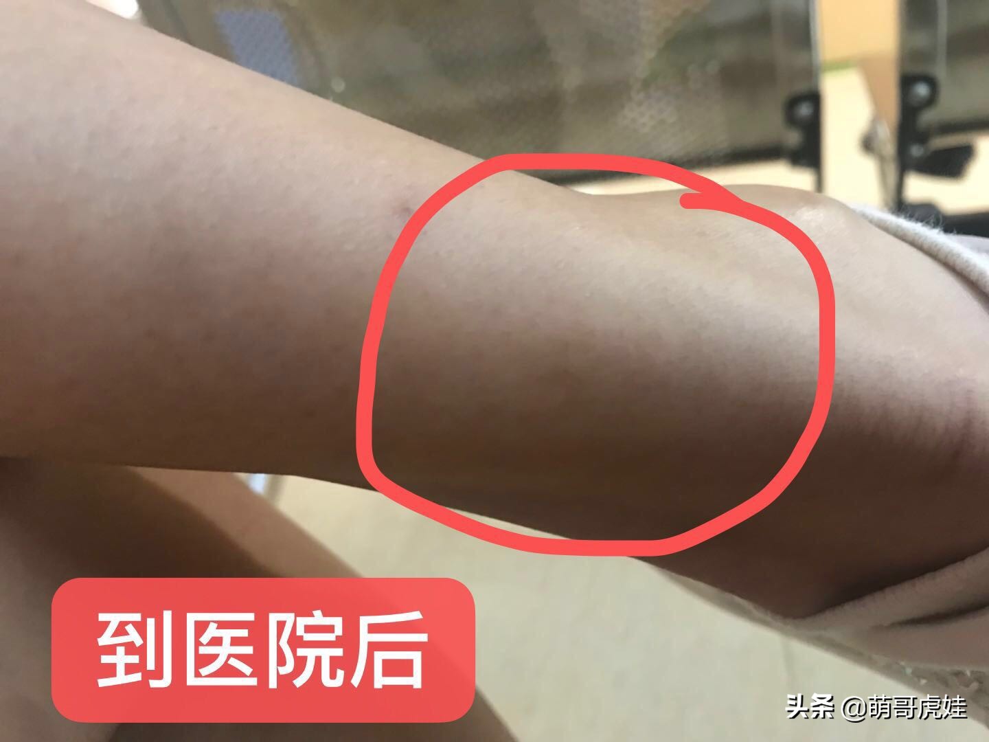 巨型贵宾遇到陌生的人乱咬怎么办,客人被猫抓伤打疫苗