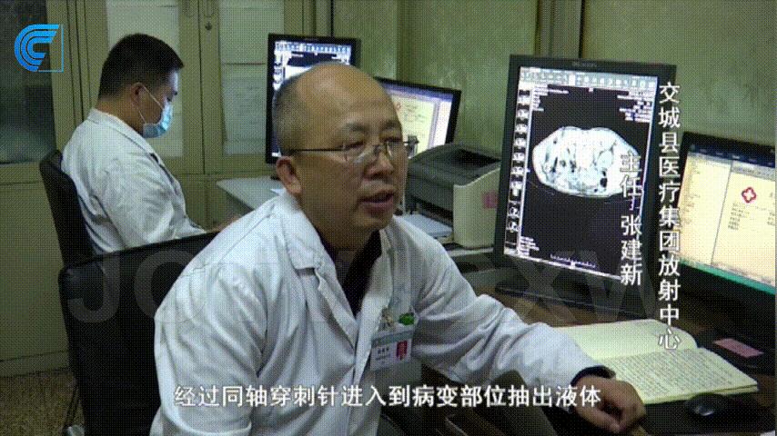 囊肿的硬化治疗技术可靠不,交城县人民医院