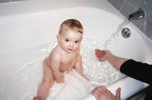 宝宝被火烧伤了怎么处理,孩子被火烧烫伤怎么办