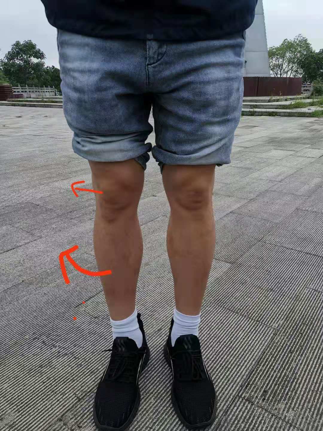 正骨导致的寰枢关节错位,自我正骨复位腰椎