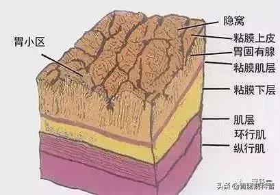 胃窦粘膜下隆起病变是胃癌吗,胃镜报告胃窦伴有隆起