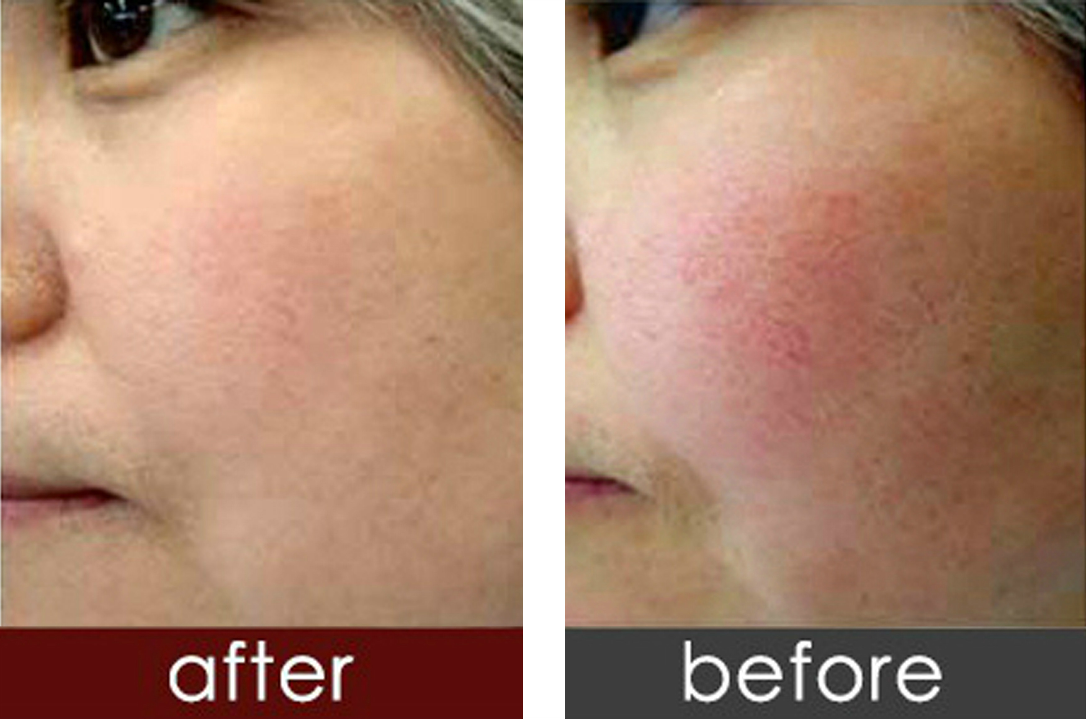 梦禾玻尿酸精华面膜,梦禾补水面膜好用吗怎么用