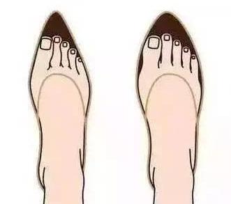 足背部疼痛常见原因是什么引起的,足跟痛的5种常见疾病解析