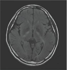 男子脚长了一个肿瘤,男子脚上长了一个红色疙瘩