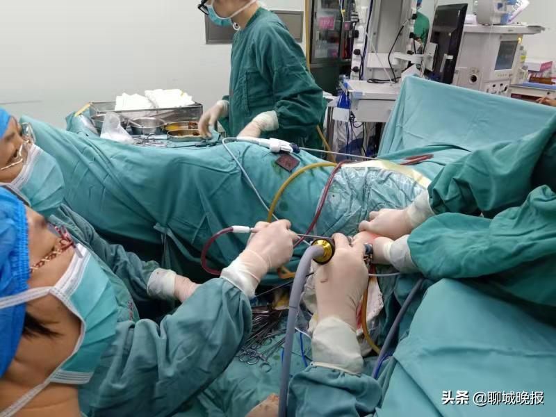“最接近完美的手术”：东昌妇幼开展首例经阴单孔腹腔镜手术，开启“无痕”新时代