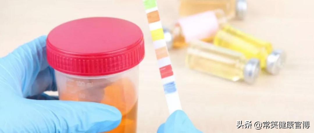 尿液淡黄色和深黄色的对比,尿液黄色和淡黄色的区别