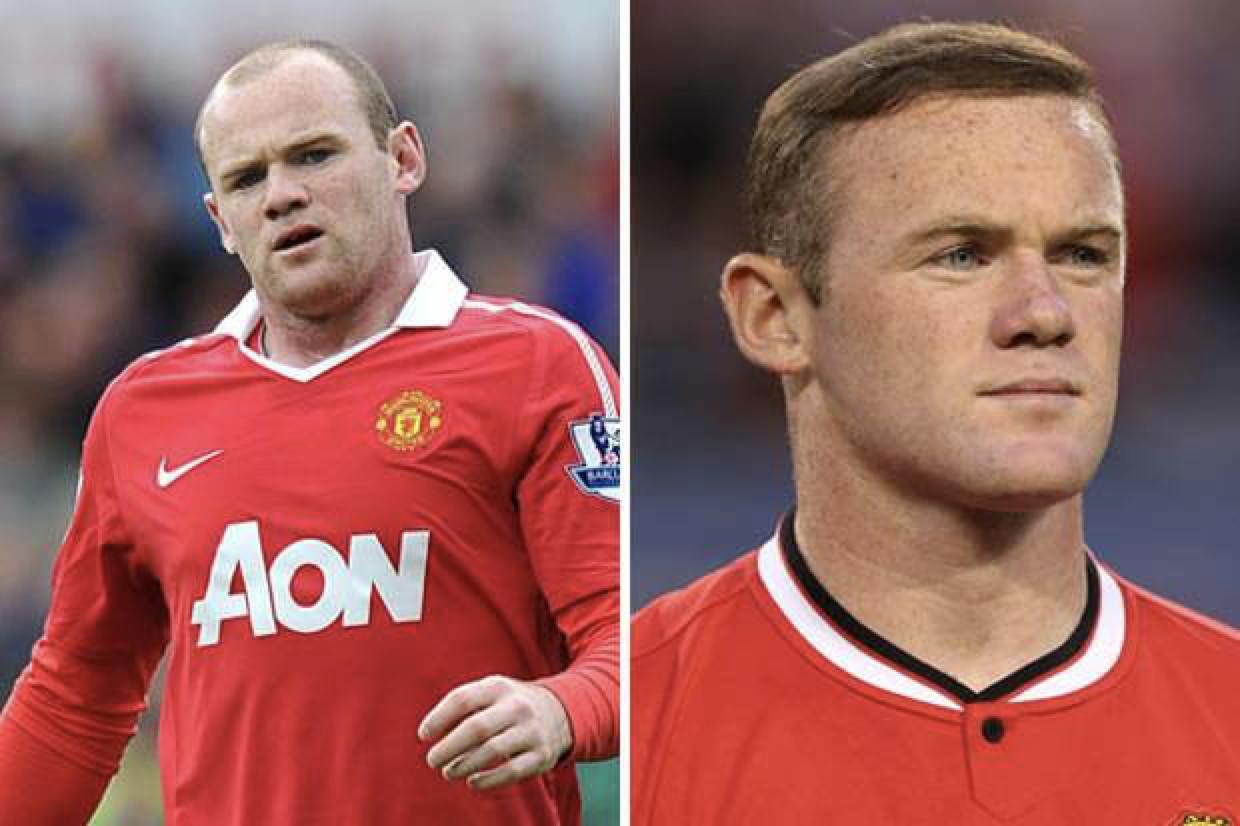 “秃”如其来的尴尬，盘点秃头的足球大咖