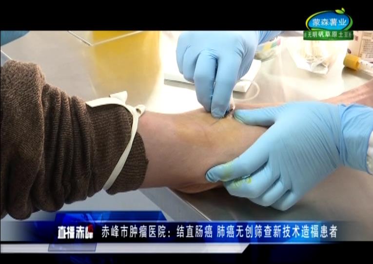 赤峰市肿瘤筛查,赤峰市肿瘤医院胃肠镜筛查