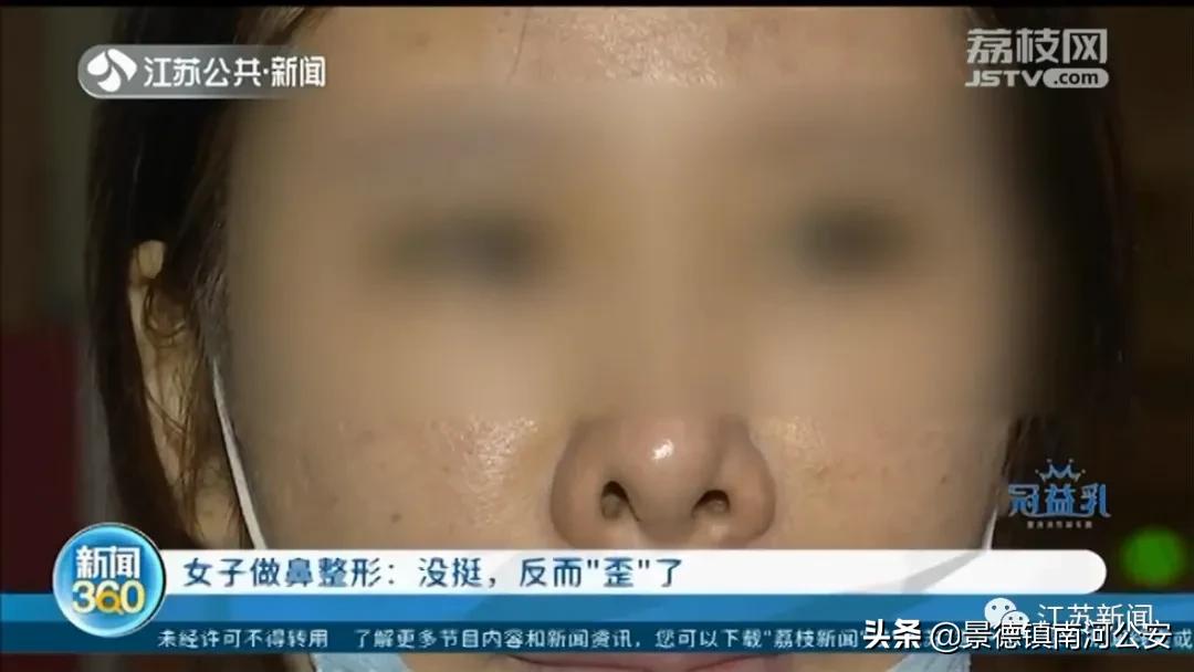 整容鼻头歪了如何修复,女子整容后全身颤抖