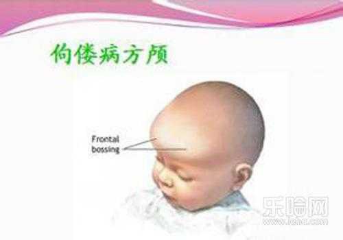 小儿惊厥抽搐有什么危害,儿童高热惊厥维生素d