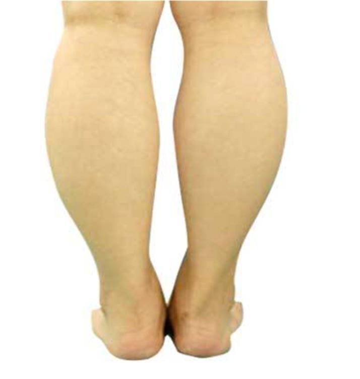 重要意见/女生腿粗类型及瘦腿方法