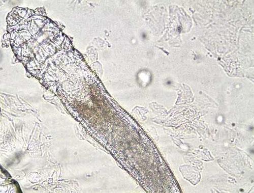 鼻子挤出螨虫怎么消除,鼻子上很多螨虫颗粒怎么解决