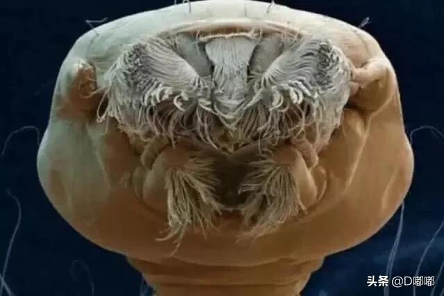 多少倍的显微镜可以看到寄生虫,15000倍显微镜下的螨虫危害