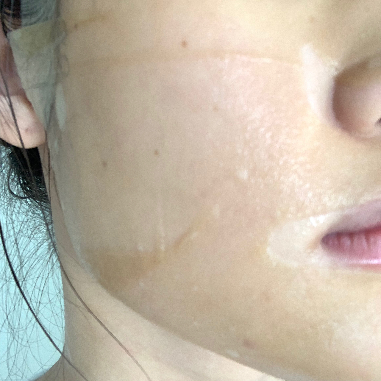 长痘痘怎么拯救痘印,长痘痘的肌肤怎么修复