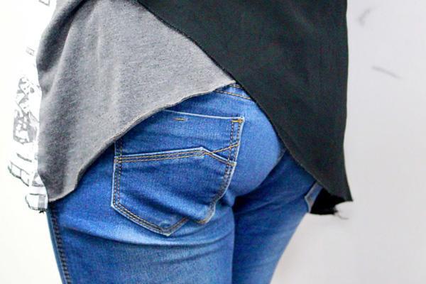 被寄生虫感染，身体或有表现，第一个很常见，可惜多数人或没在意