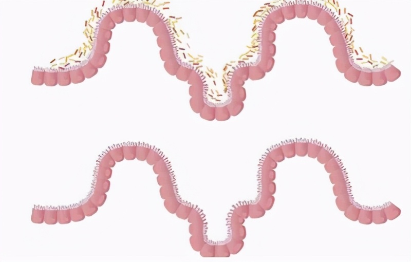 糖尿病干细胞研究进展,糖尿病医学研究进展