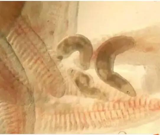 寄生虫病防治措施,寄生虫病如何防治