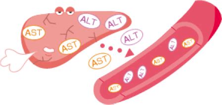 体检查出非均匀脂肪肝怎么治疗,体检查出非酒精性脂肪肝