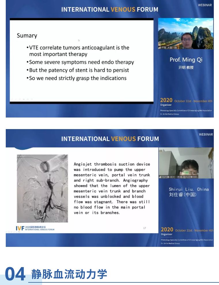 开幕第一天精彩回顾｜2020国际静脉病论坛持续进行中