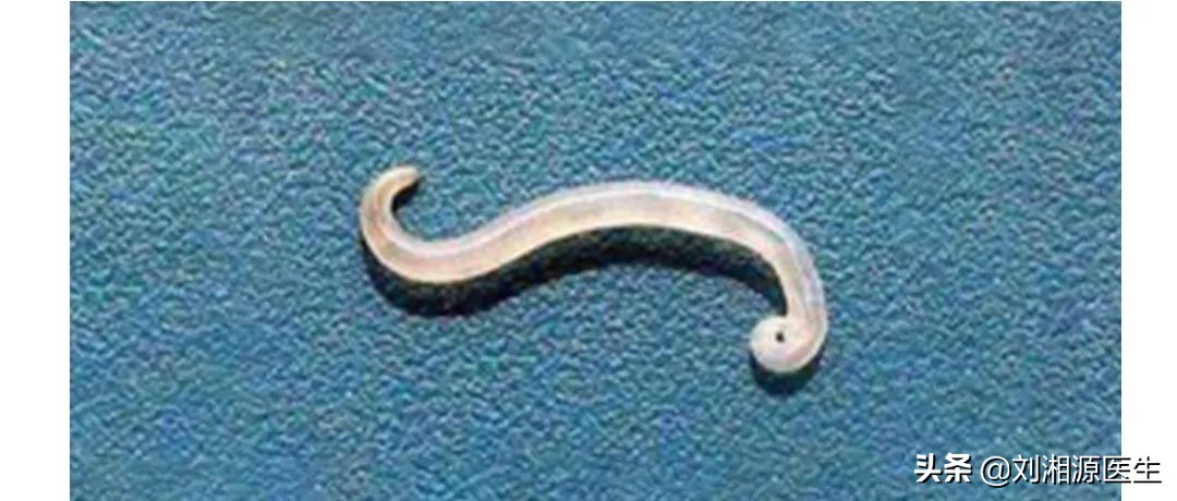 免疫相关不良妊娠答疑解惑,torch五项风疹病毒阳性