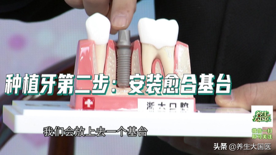 牙齿不整齐怎么修复,牙齿楔状缺损用树脂250好还是350好