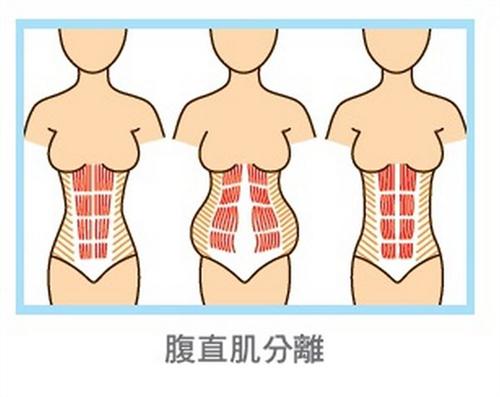 10个黄金动作帮助产后恢复,一般产后恢复做什么项目