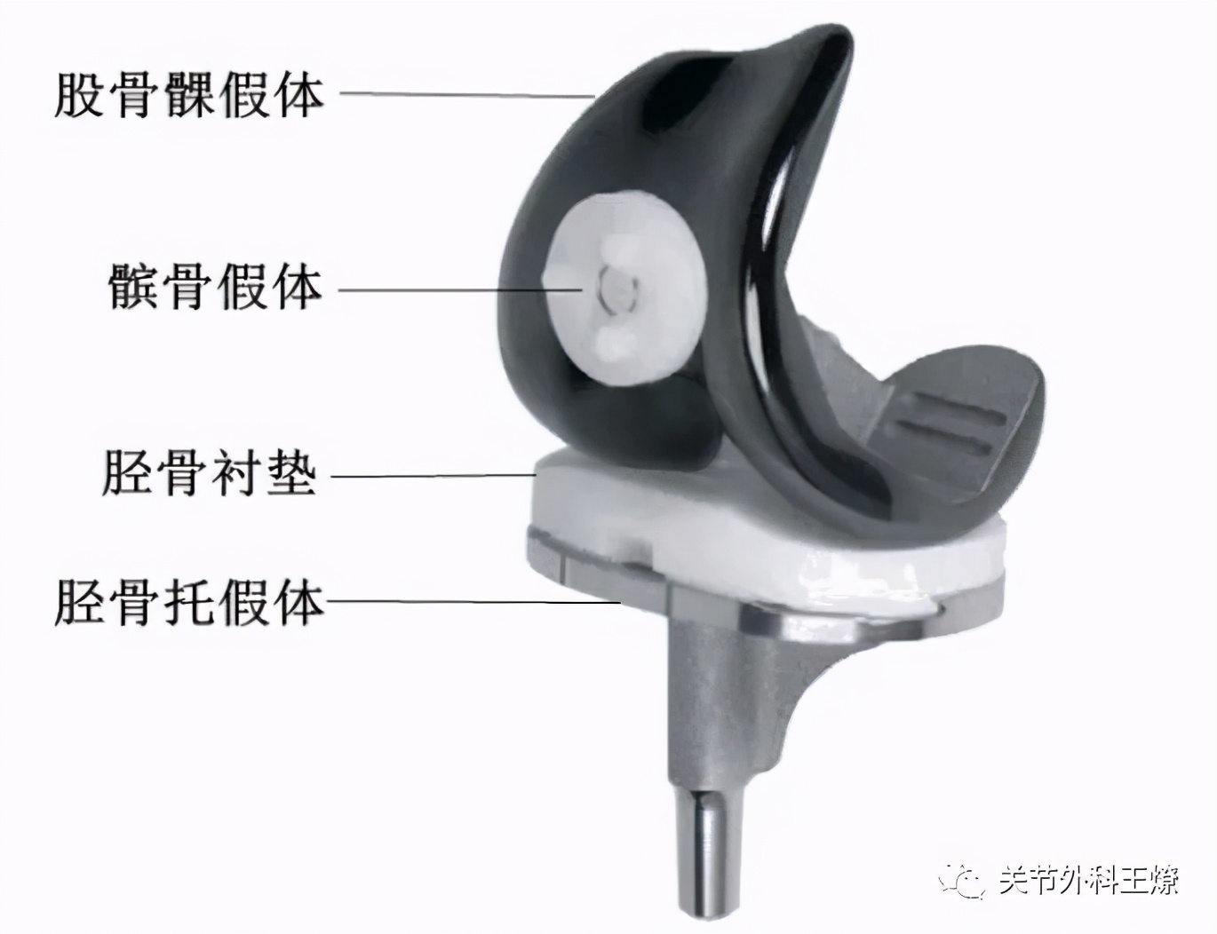 人工膝关节什么时间降价,人工膝关节使用60年寿命