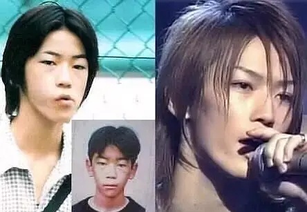 日本整容惊人案例,日本整容是不是最先进