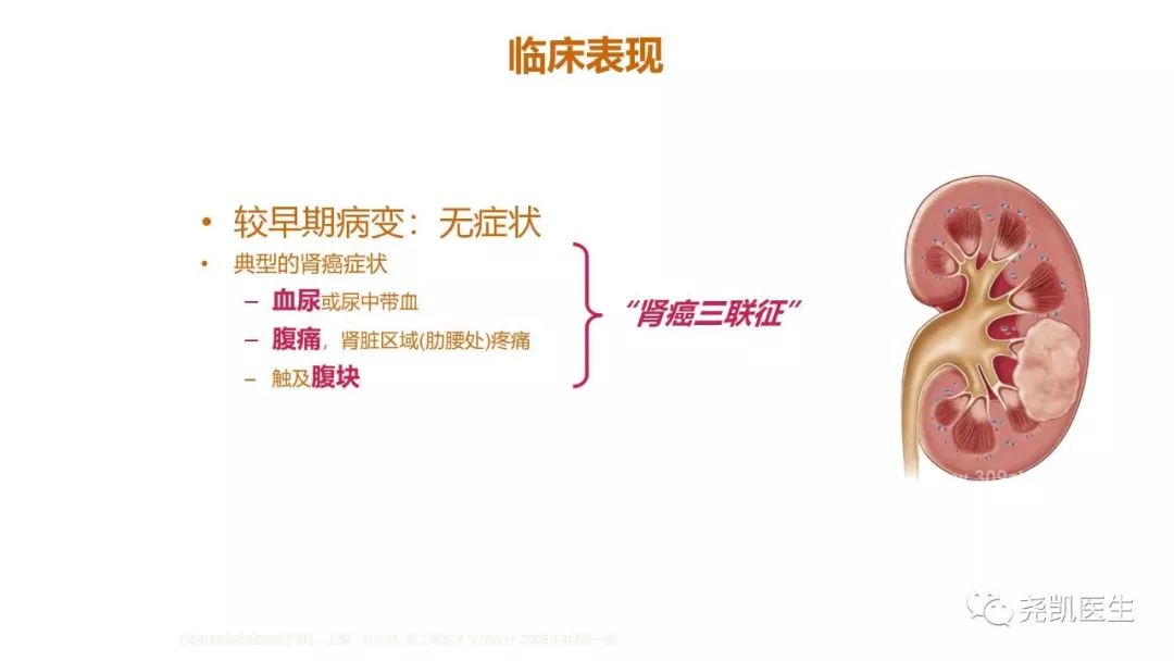 肾脏有包块饮食应注意什么,肾包块是什么