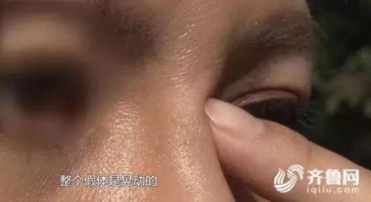 女子整容换脸后续,整容死亡真实案例