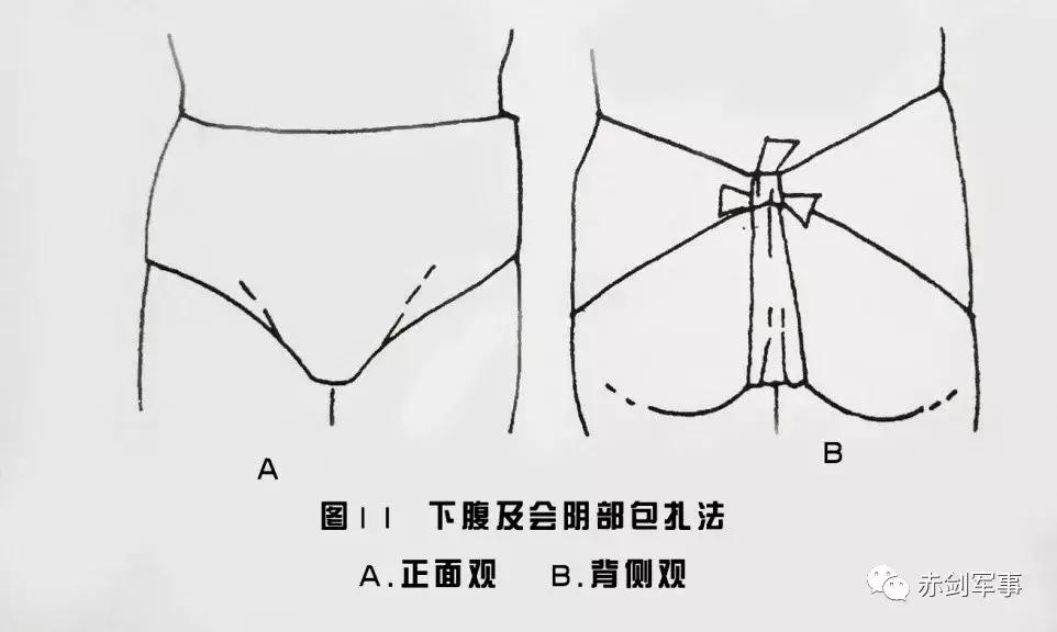 军队三角巾包扎法视频,部队卫生与救护三角巾包扎方法