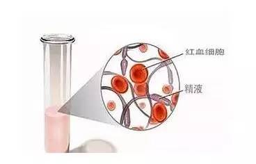 周强男科医生靠谱吗,男科周强教授