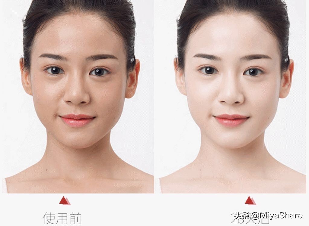 夏天适合薇诺娜美白精华推荐,薇诺娜美白精华次抛测评