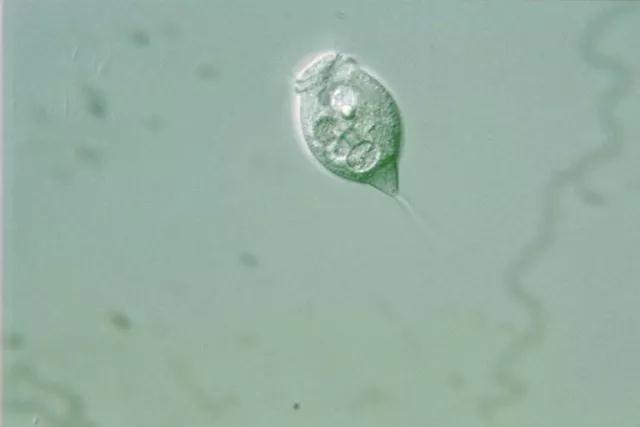 收藏!24种污水处理微生物菌相及指导意义,环保人必看(多图)