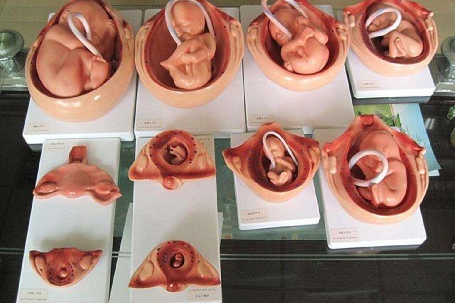 胎儿有了心跳孕妇会有反应吗,胎儿心率过快能直接引产吗