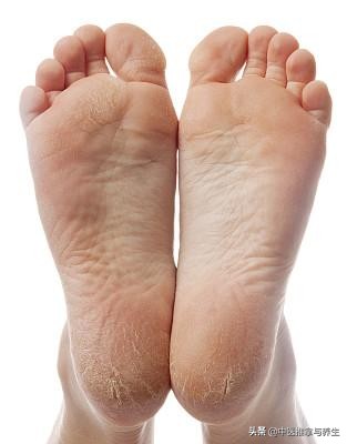 为什么一不做足疗脚底就疲劳,大家为啥喜欢做足疗