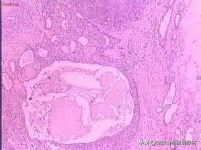 痒痒的还起了小疙瘩,痒痒的特别小的红疙瘩是怎么回事