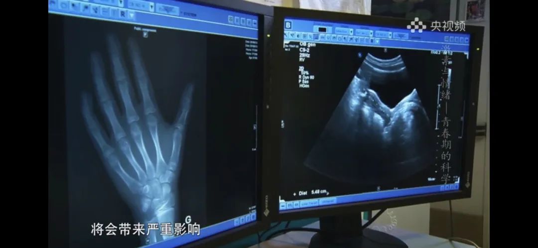 怎么知道孩子是否提前发育,怎么知道孩子提前发育