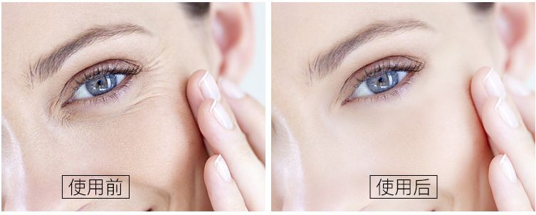 一年四季都能用的保湿面霜,皮肤干推荐一款好用的面霜