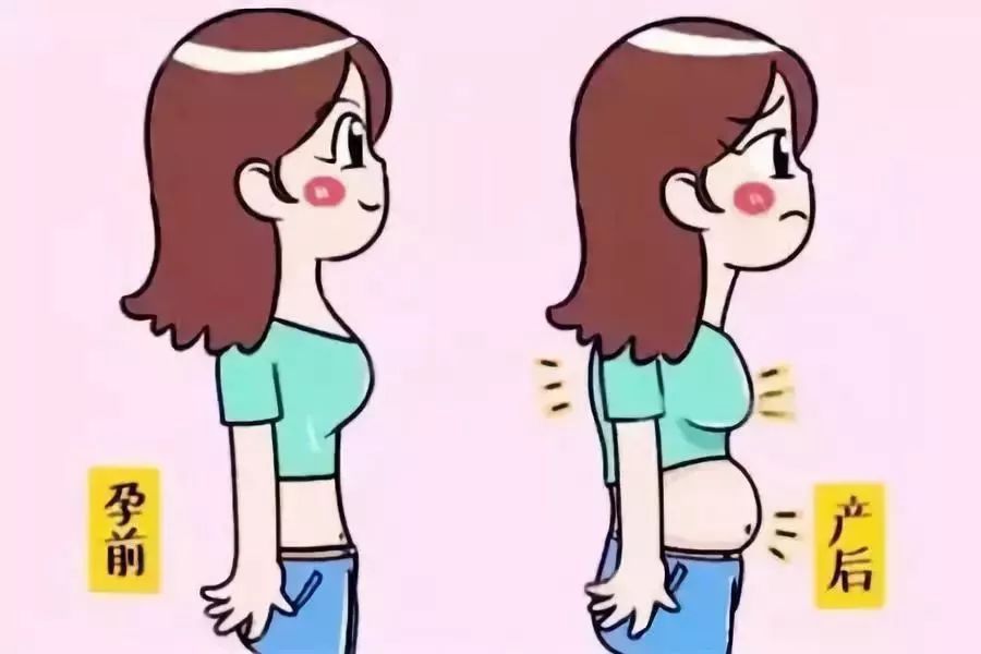 生宝宝选择剖腹产也需要做盆底肌修复，越早越好莫拖延