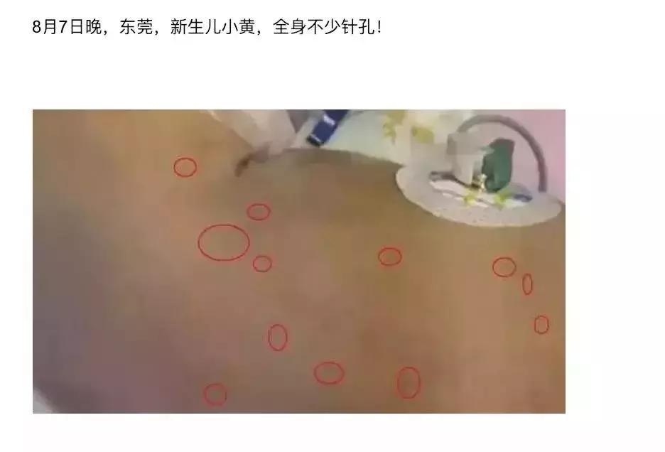 儿科偏方大全100个,民间偏方害惨小孩