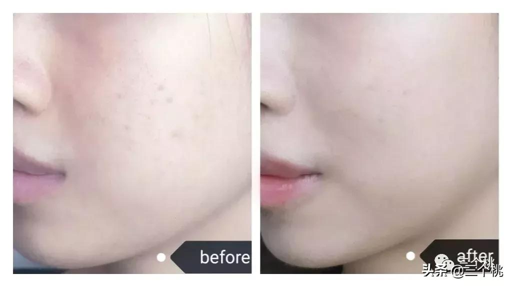 口碑最好十大粉底液夏季,十大公认好用的粉底液及价格