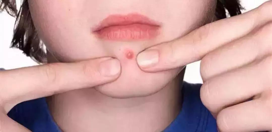 绮炬补鎶よ偆鏋滄补,绮炬补鍜屾灉娌瑰摢涓ソ