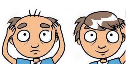 植发后如何科学护理，可以避免发炎水肿？